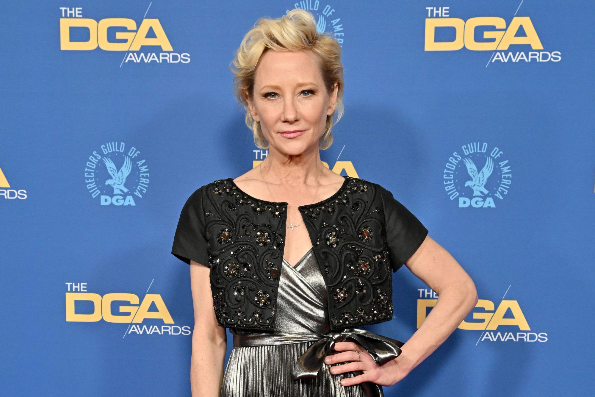 LAPD Will Not Investigate Anne Heche’s Car Crash: Cops Confirm