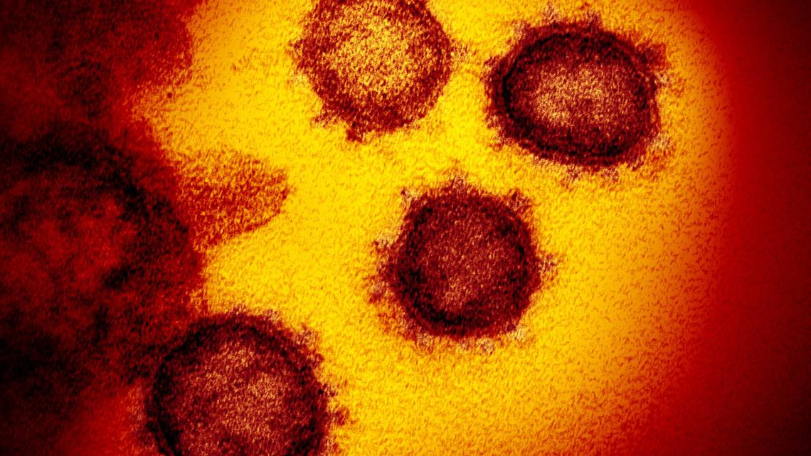 Coronavirus: SLO County adds 4 COVID-19 deaths, 371 cases