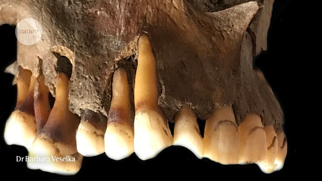 Historic tooth DNA reveals how ‘chilly sore’ herpes virus has advanced