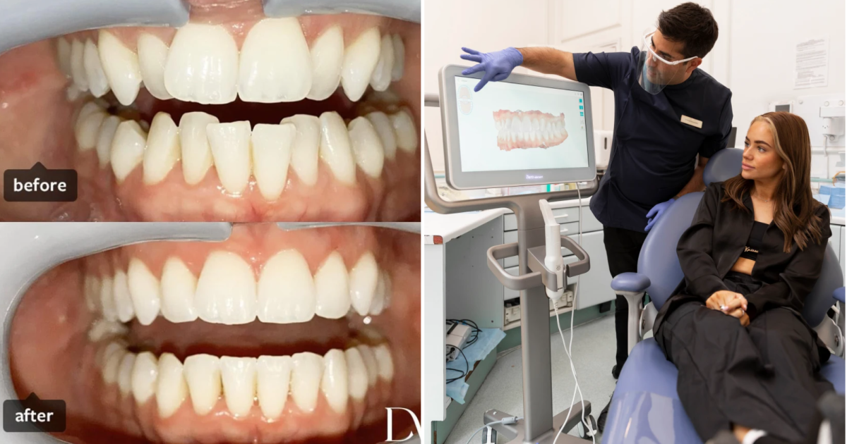 Dentist Dr Richard Marques provides straight enamel for as much as 70% much less