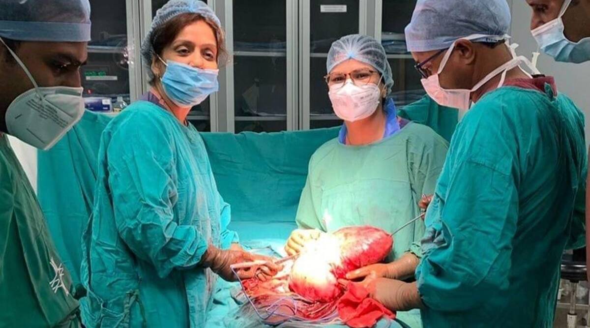 Uncommon fibroid extracted in delicate surgical procedure at Gurugram hospital