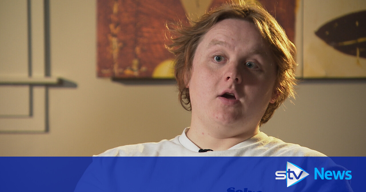 What’s On Scotland: Lewis Capaldi reveals celeb crush is Davina McCall and comeback nerves