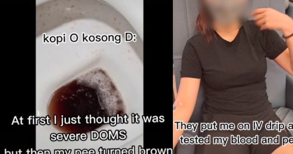 ‘My pee turned brown like kopi-o kosong’: Lady’s first spin class lands her in A&E, Singapore Information