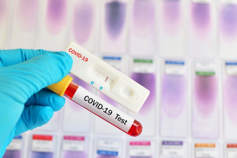 53 folks contract coronavirus in Kazakhstan in previous 24h