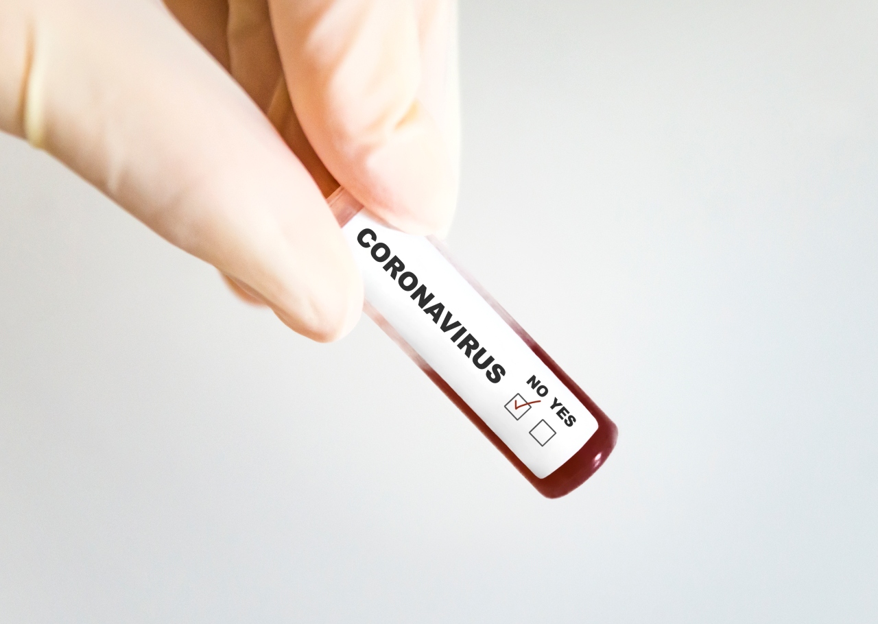 COLORADO CORONAVIRUS: Almost each county in Colorado has low COVID-19 group stage