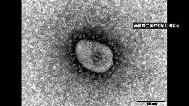 Coronavirus infections stay at excessive degree in Hokkaido