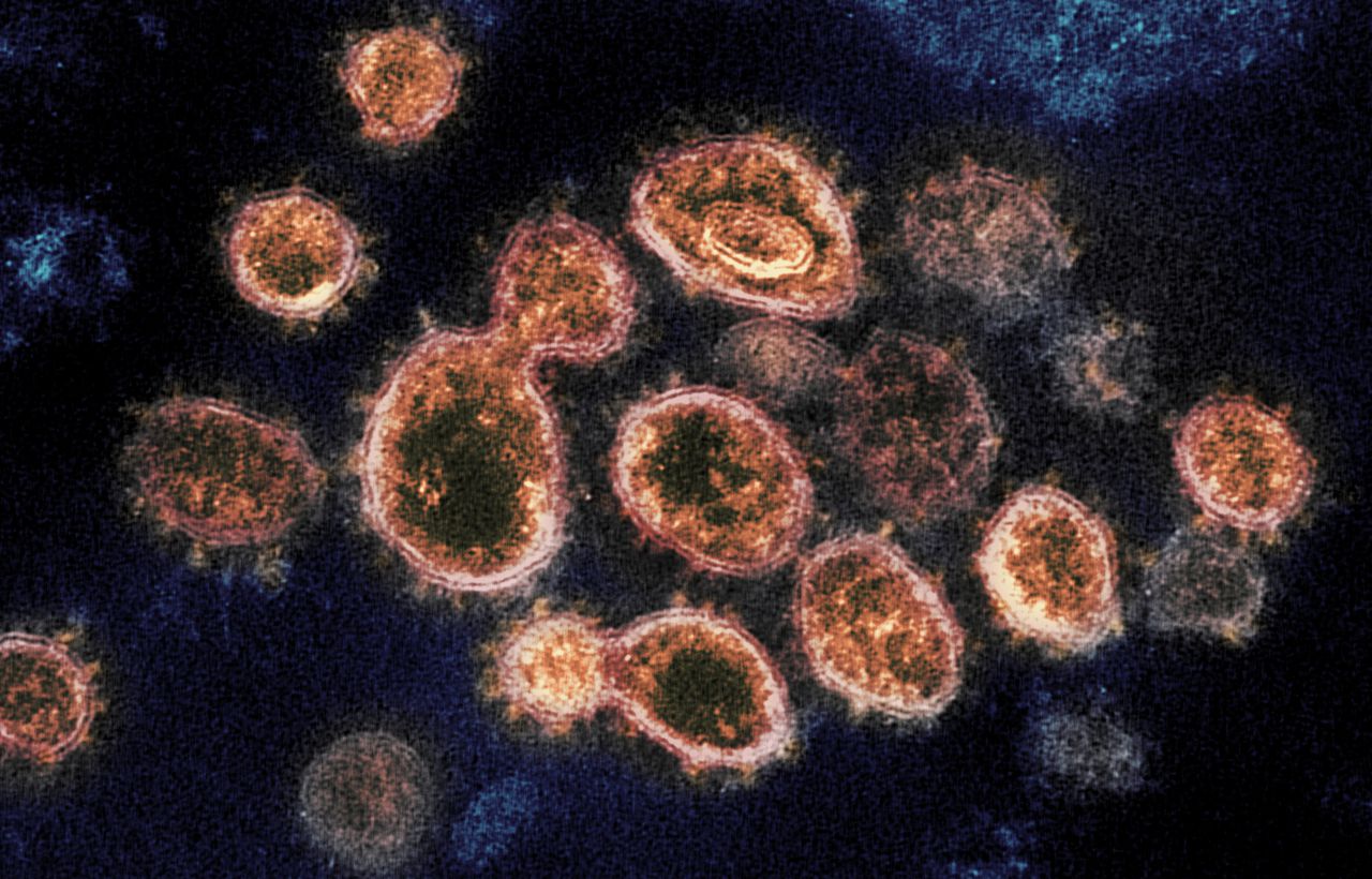 Ohio reviews 9,424 extra COVID-19 circumstances; six-day coronavirus replace for Wednesday, Nov. 23