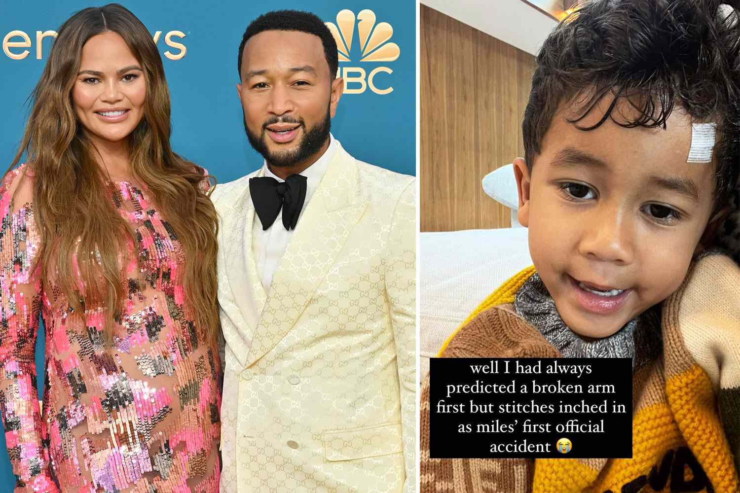 Chrissy Teigen’s Son Miles Will get Stitches in ‘First Official Accident’