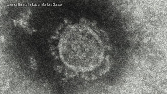 Three years since Japan confirmed its first case of coronavirus an infection