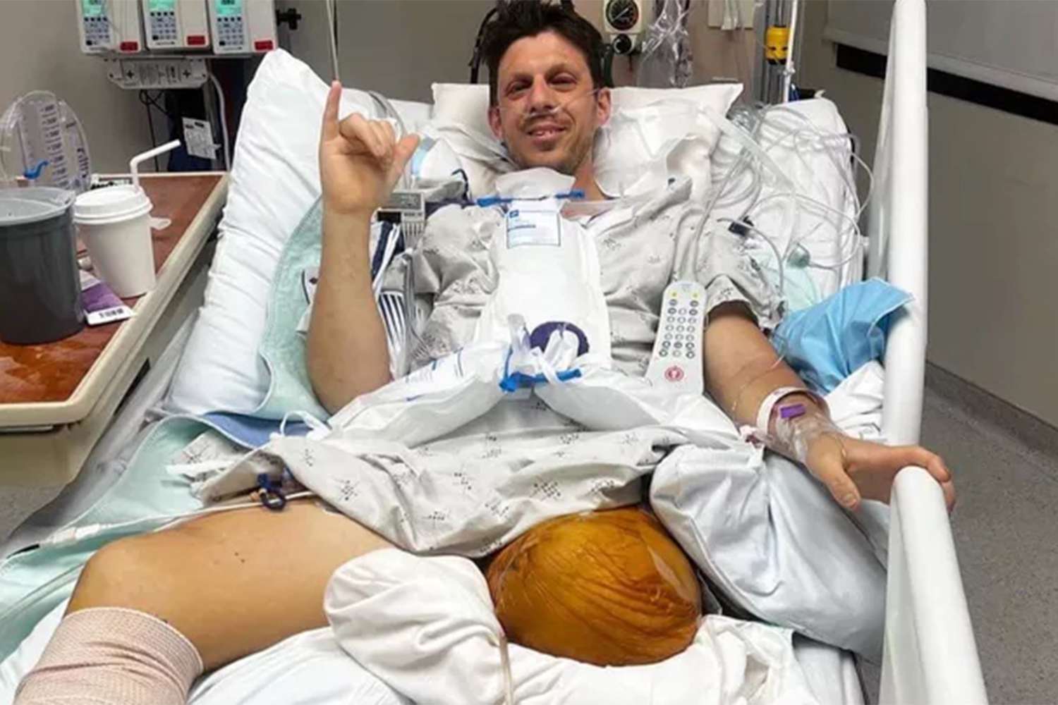 Father Loses Each Legs After he Protects Household in Snow Blower Accident