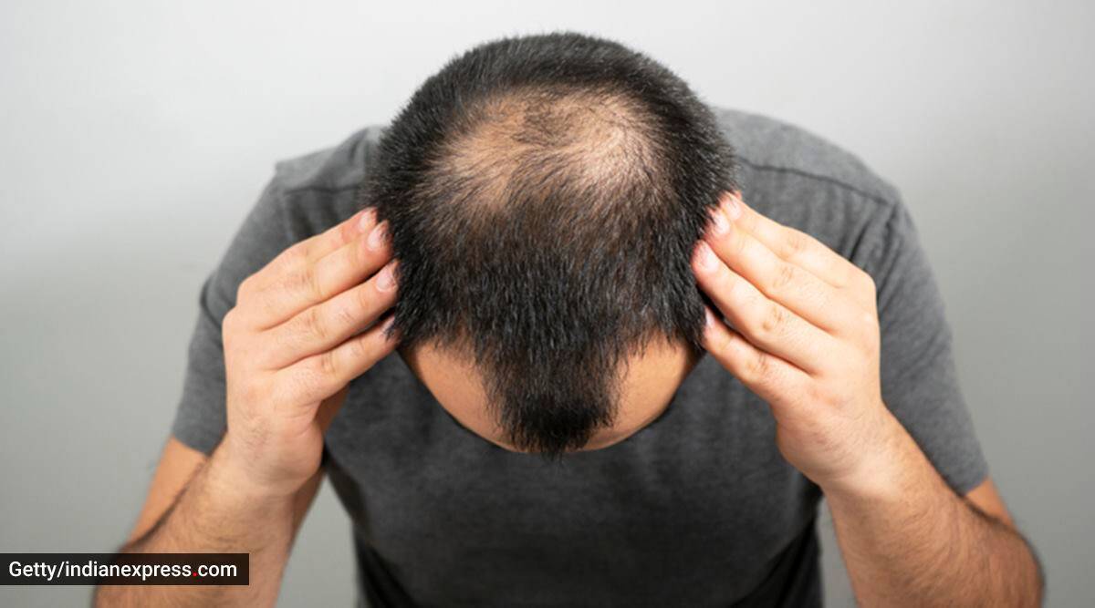 Can sugar-sweetened drinks result in hair loss in males?