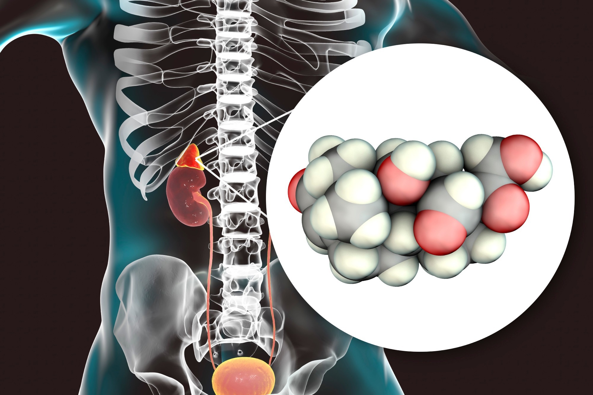 Affiliation of aldosterone with perfect cardiovascular well being in incident diabetes