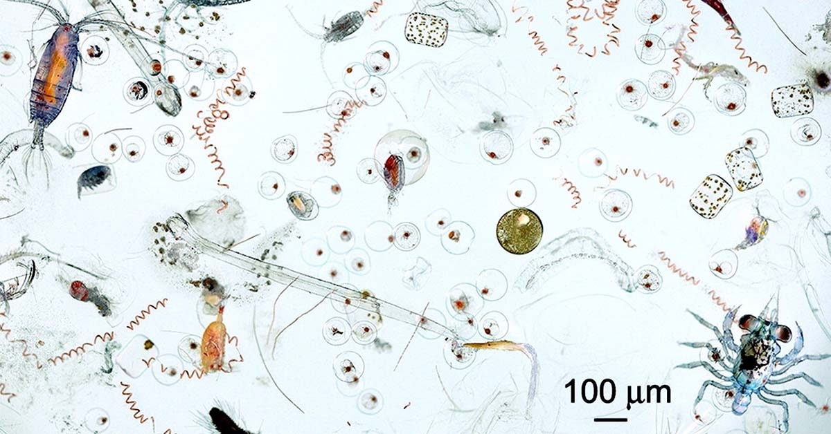 Marine Plankton Inform the Lengthy Story of Ocean Well being, and Perhaps Human Too